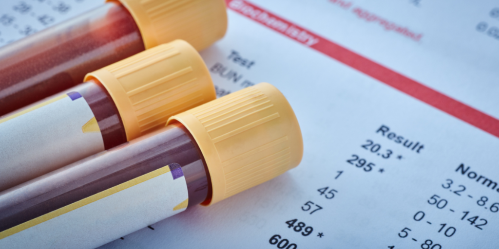 Blood Test Screening